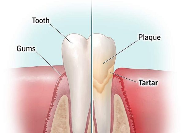 Zubni kamenac kod pasa i mačaka